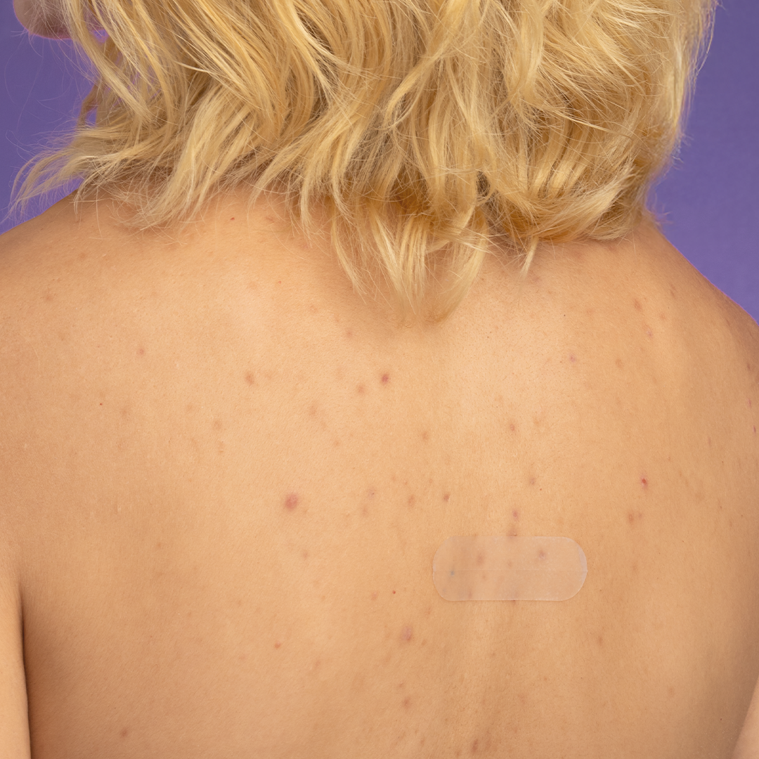 Adesivos Secativos Transparente Oval - 8 unidades